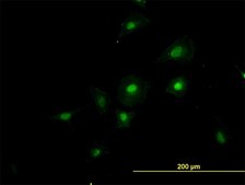 Monoclonal Anti-RNPC2 antibody produced in mouse clone 4G8, purified immunoglobulin, buffered aqueous solution