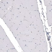 Monoclonal Anti-CDKL5 antibody produced in mouse Prestige Antibodies® Powered by Atlas Antibodies, clone CL4888, purified immunoglobulin, buffered aqueous glycerol solution