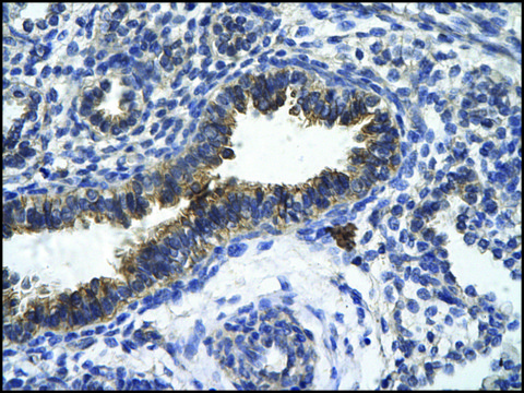 Anti-ZFR antibody produced in rabbit affinity isolated antibody