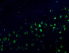 Anti-Alzheimer Precursor Protein A4 Antibody, clone 22C11, Alexa488 Conj. clone 22C11, from mouse, ALEXA FLUOR™ 488