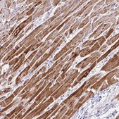 Anti-NDUFS2 antibody produced in rabbit Prestige Antibodies® Powered by Atlas Antibodies, affinity isolated antibody, buffered aqueous glycerol solution