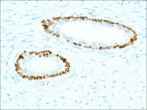 Anti-SOX-2 antibody, Rabbit monoclonal recombinant, expressed in proprietary host, clone SP76, affinity isolated antibody