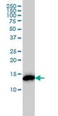 Monoclonal Anti-RPS19 antibody produced in mouse clone 3C6, ascites fluid