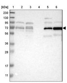 Anti-RIPK2 antibody produced in rabbit Prestige Antibodies® Powered by Atlas Antibodies, affinity isolated antibody, buffered aqueous glycerol solution