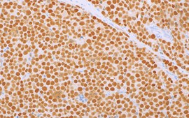 MAGEC2 (EP405) Rabbit Monoclonal Primary Antibody