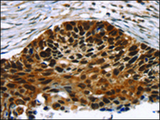 Anti-TACC2 affinity isolated antibody