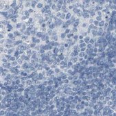 Anti-OPN1SW antibody produced in rabbit Prestige Antibodies® Powered by Atlas Antibodies, affinity isolated antibody