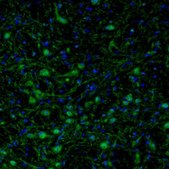 Anti-ARHGAP1 antibody produced in rabbit Prestige Antibodies® Powered by Atlas Antibodies, affinity isolated antibody, buffered aqueous glycerol solution