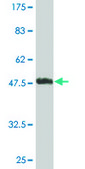 Monoclonal Anti-UBE2T antibody produced in mouse clone 4G1-4C2, purified immunoglobulin, buffered aqueous solution
