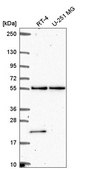 Anti-POLR3D antibody produced in rabbit Prestige Antibodies® Powered by Atlas Antibodies, affinity isolated antibody