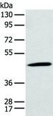 Anti-CCBL1 affinity isolated antibody