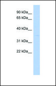 Anti-STUB1, (N-terminal) antibody produced in rabbit affinity isolated antibody