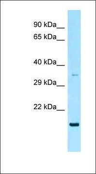 Anti-RAP2A antibody produced in rabbit affinity isolated antibody