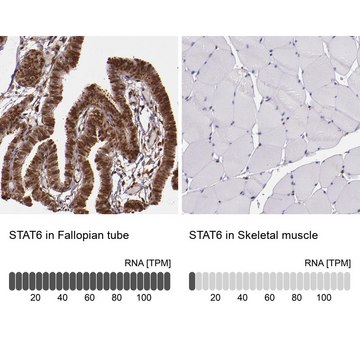 Anti-STAT6 antibody produced in rabbit affinity isolated antibody, buffered aqueous glycerol solution