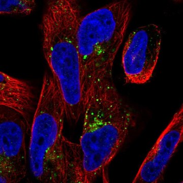 Anti-TMEM123 antibody produced in rabbit Prestige Antibodies&#174; Powered by Atlas Antibodies, affinity isolated antibody