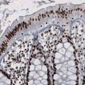 Monoclonal Anti-HNRNPC antibody produced in mouse Prestige Antibodies® Powered by Atlas Antibodies, clone CL2596, purified immunoglobulin, buffered aqueous glycerol solution