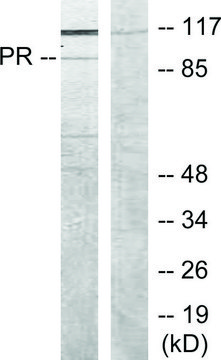 Anti-Progesterone Receptor antibody produced in rabbit affinity isolated antibody