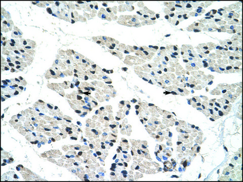 Anti-RALY antibody produced in rabbit IgG fraction of antiserum