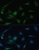 Anti- p38 MAPK antibody produced in rabbit