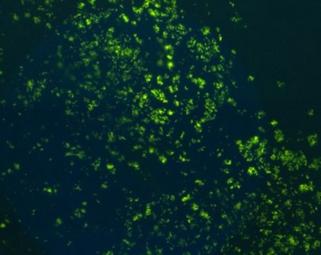 AFB-Fluor Staining kit for fluorescence-microscopic detection of acid fast bacteria