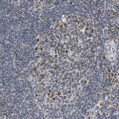 Anti-ELAC2 antibody produced in rabbit Prestige Antibodies® Powered by Atlas Antibodies, affinity isolated antibody, buffered aqueous glycerol solution