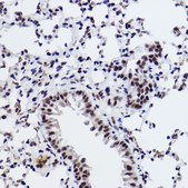 Anti-SNRPA1 Antibody, clone 2D7M1, Rabbit Monoclonal