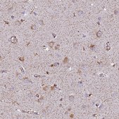 Anti-CLCN7 antibody produced in rabbit Prestige Antibodies® Powered by Atlas Antibodies, affinity isolated antibody, buffered aqueous glycerol solution