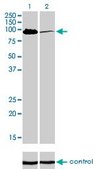 Monoclonal Anti-MCC antibody produced in mouse clone 1A7, purified immunoglobulin, buffered aqueous solution
