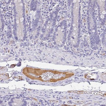 Anti-APOB antibody produced in rabbit Prestige Antibodies&#174; Powered by Atlas Antibodies, affinity isolated antibody, buffered aqueous glycerol solution