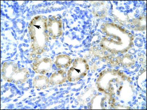 Anti-TBX1 IgG fraction of antiserum