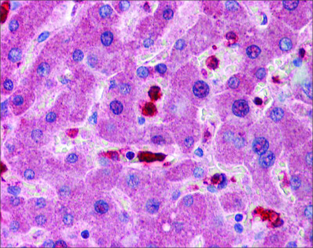 Anti-GCLM antibody produced in rabbit affinity isolated antibody