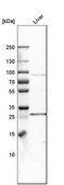 Anti-SLC27A3 antibody produced in rabbit Prestige Antibodies® Powered by Atlas Antibodies, affinity isolated antibody, buffered aqueous glycerol solution