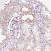 Anti-GSDMC antibody produced in rabbit Prestige Antibodies® Powered by Atlas Antibodies, affinity isolated antibody, buffered aqueous glycerol solution, Ab3