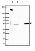 Anti-SCLY antibody produced in rabbit Prestige Antibodies® Powered by Atlas Antibodies, affinity isolated antibody, buffered aqueous glycerol solution