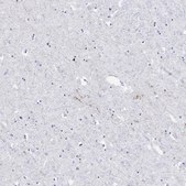 Anti-CARTPT antibody produced in rabbit Prestige Antibodies® Powered by Atlas Antibodies, affinity isolated antibody, buffered aqueous glycerol solution