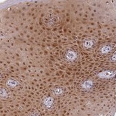 Anti-GBP2 antibody produced in rabbit Prestige Antibodies® Powered by Atlas Antibodies, affinity isolated antibody, buffered aqueous glycerol solution