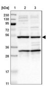 Anti-AVEN antibody produced in rabbit Prestige Antibodies® Powered by Atlas Antibodies, affinity isolated antibody, buffered aqueous glycerol solution
