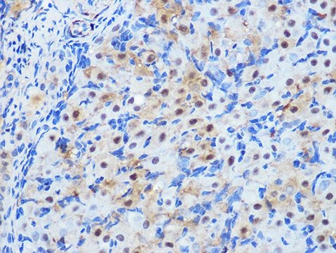 Anti-PP1 beta antibody produced in rabbit