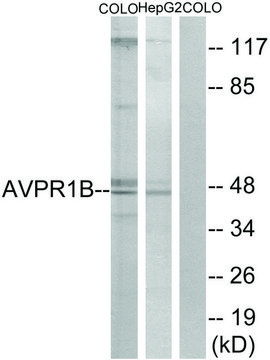 Anti-AVPR1B antibody produced in rabbit affinity isolated antibody