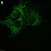 Anti-SLC19A1 Antibody, clone 2E11 ZooMAb® Rabbit Monoclonal recombinant, expressed in HEK 293 cells