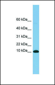 Anti-B2M, (N-terminal) antibody produced in rabbit affinity isolated antibody