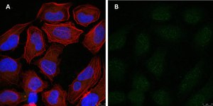 Anti-p-Ubiquitin (pSer65) Antibody, clone 2N21 ZooMAb® Rabbit Monoclonal recombinant, expressed in HEK 293 cells