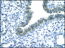 Anti-CCRN4L antibody produced in rabbit IgG fraction of antiserum