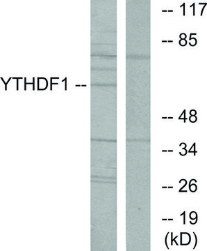 Anti-YTHDF1 antibody produced in rabbit affinity isolated antibody