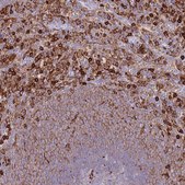 Anti-EFHD2 antibody produced in rabbit Prestige Antibodies® Powered by Atlas Antibodies, affinity isolated antibody, buffered aqueous glycerol solution