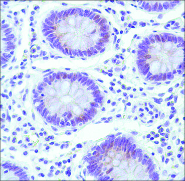 Anti-Cyclin E1 antibody, Rabbit monoclonal recombinant, expressed in proprietary host, clone SP146, affinity isolated antibody