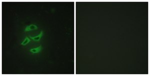 Anti-Cytochrome P450 2J2 antibody produced in rabbit affinity isolated antibody