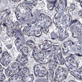 Anti-TTBK1 antibody produced in rabbit Prestige Antibodies® Powered by Atlas Antibodies, affinity isolated antibody, buffered aqueous glycerol solution