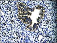 Anti-EGR2 antibody produced in rabbit affinity isolated antibody