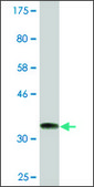Monoclonal Anti-ARMC4, (C-terminal) antibody produced in mouse clone 5F1, ascites fluid